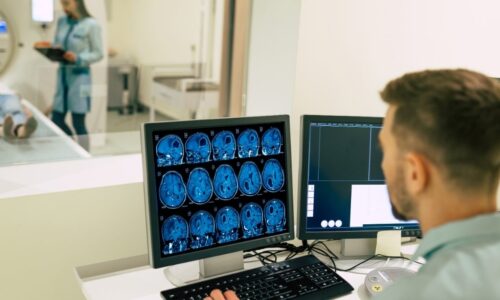 IA identifica avanço do Alzheimer com apenas uma ressonância magnética