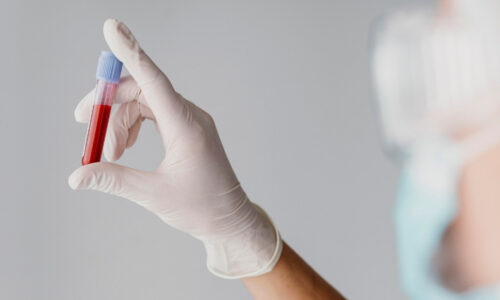 Sangue pode revelar riscos de doenças graves antes dos primeiros sinais
