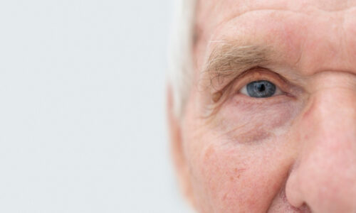 Estudo indica relação entre retina e risco de Alzheimer