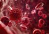 Remédio contra câncer de sangue freia doença em quase 80% dos pacientes